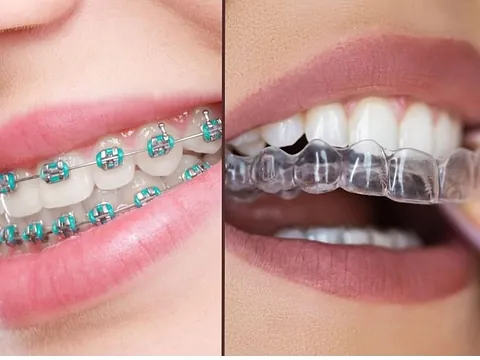 Clínica Dental Maestre Ortodoncia Brackets e invisible 