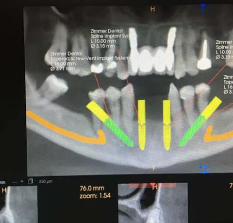 Señor en odontología