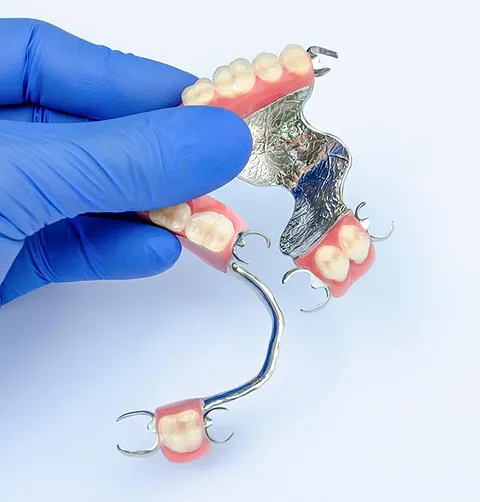 Prótesis dental
