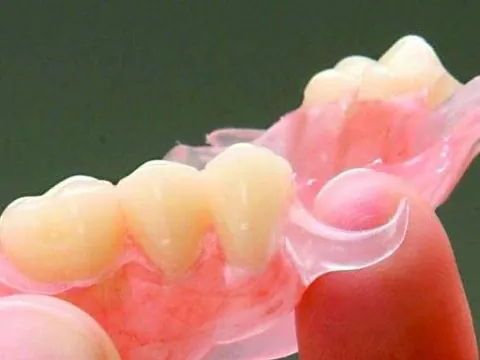 Clínica Dental Maestre ferula de descarga 