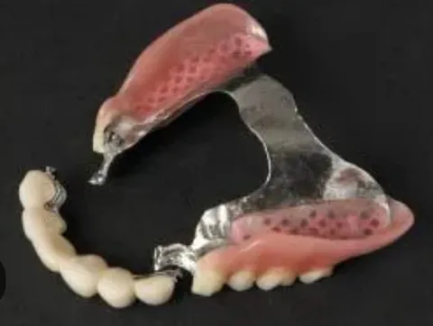 Clínica Dental Maestre Protesis mixta , esqueletico y puente metal porcela con ataches